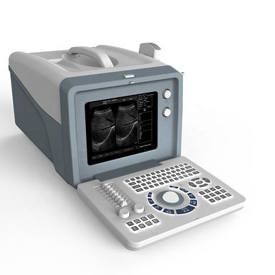 ποιότητας  Ultrasound laptop diagnostic ultrasound machine /black and white ultrasound scanner with 15 inch LCD screen εργοστάσιο