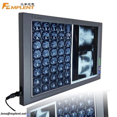 ποιότητας  Super Bright Digital Dual General Film Medical Negatoscope LED X Ray Viewer εργοστάσιο