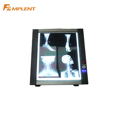 General Mplent movie led x ray movie illuminator view box with low price factory